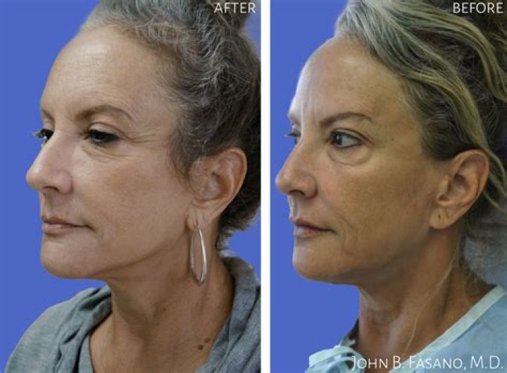 Plastic Surgeon John Fasano Finds His Inspiration In The Arts